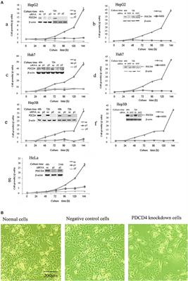 PDCD4 Knockdown Induces Senescence in Hepatoma Cells by Up-Regulating the p21 Expression